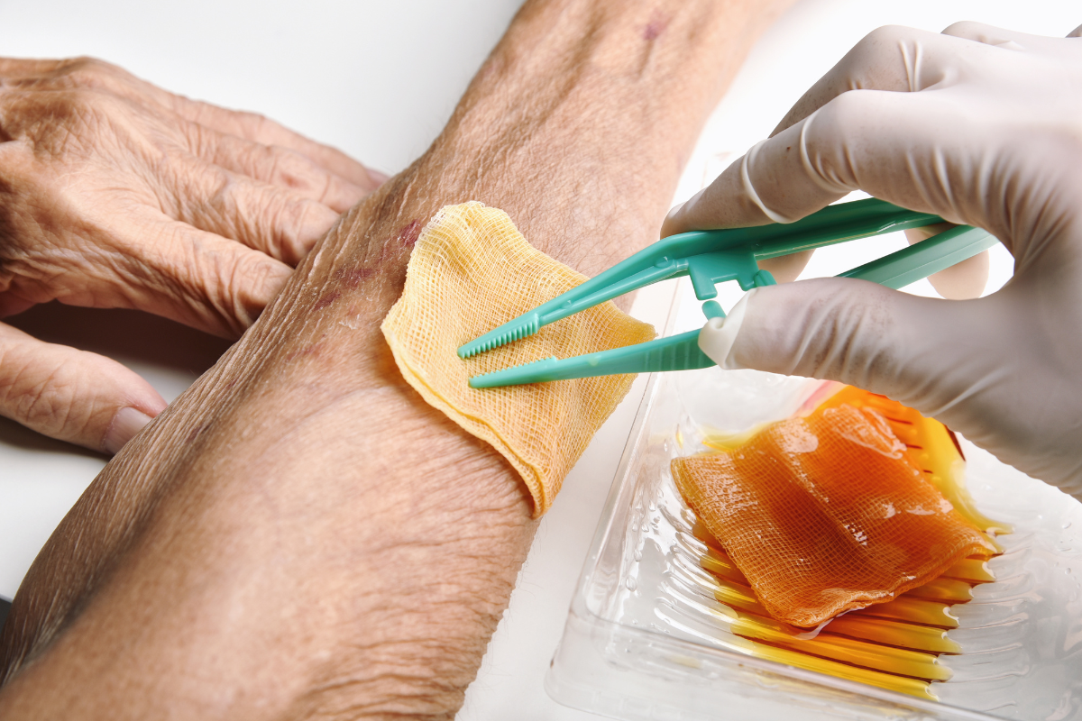 What Does Wound Care Include