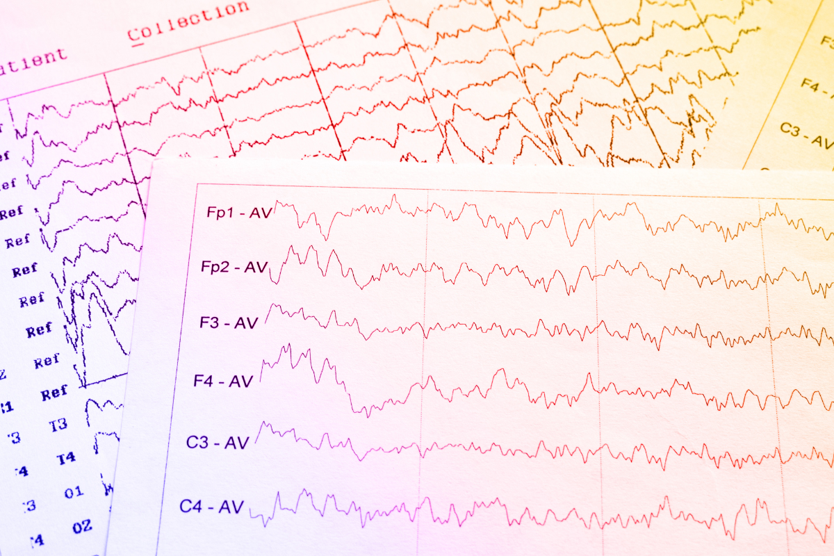 Ejemplo de resultados de EEG de exploración neural