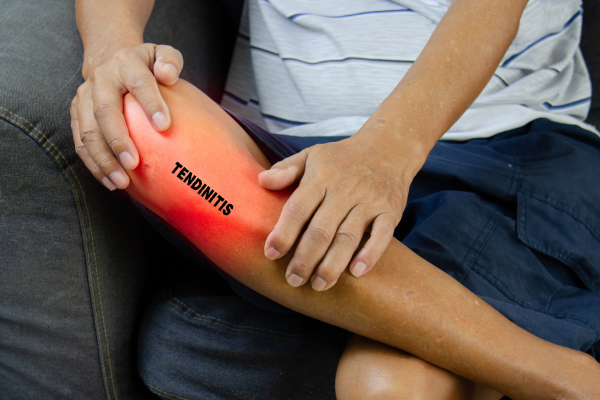 Una imagen de un hombre sujetándose la rodilla debido a una tendinitis